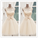 Lace 2022 Short Homecoming Dress Prom Dresses - Laurafashionshop